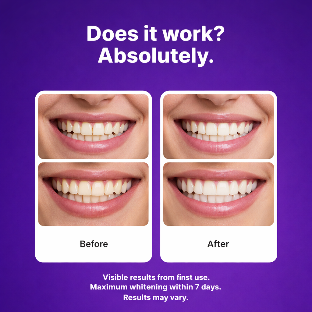 Teeth Whitening Strips By Dropavia – Visible Results in 30 Minutes